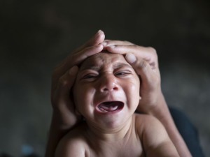 Zika